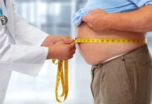 When Does Obesity Become Serious?